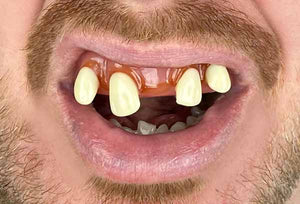 Billy Bob Tiger Man Teeth